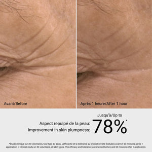 G.M. Collin Hyaluronic Filler serumo rezultatai prieš ir po