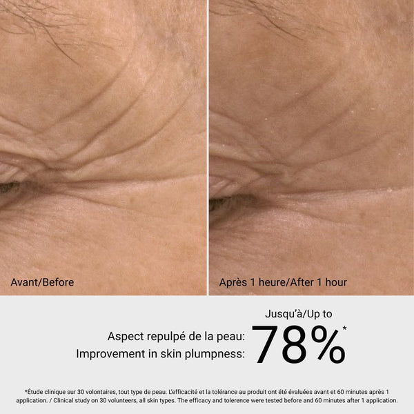 G.M. Collin Hyaluronic Filler serumo rezultatai prieš ir po